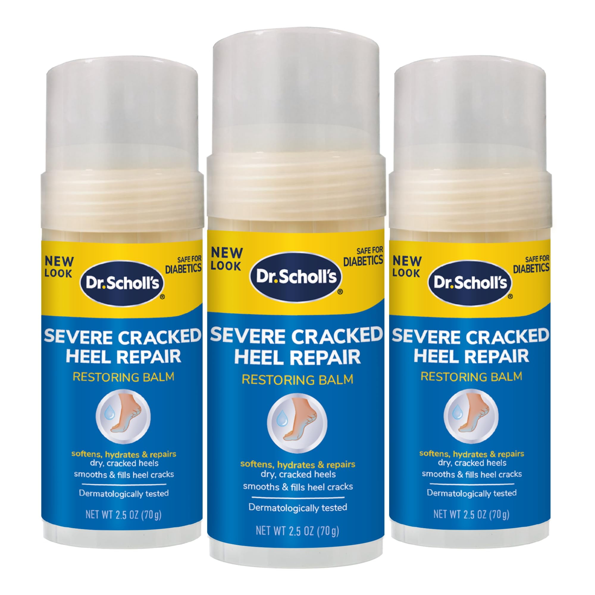 Severe Cracked Heels Treatment55866771