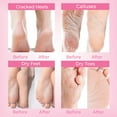 thumbnail image 3 of SAISZE Exfoliating Foot Peel Mask with Lavender Oil, Deep Moisturizing Foot Masks for Dry, Rough & Callused Skin, 4 Pairs, 3 of 8
