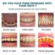 thumbnail image 3 of EELHOE 15ml Instant Tooth Whitening Paint Remove Stains Fresh Breath No Sensitivity Qui, 3 of 5