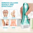 thumbnail image 6 of Callus Remover for ,  Electric Foot File Callus Removers Rechargeable  Pedicure Tools Foot    Care Tool for Cracked Heels   (Green), 6 of 6