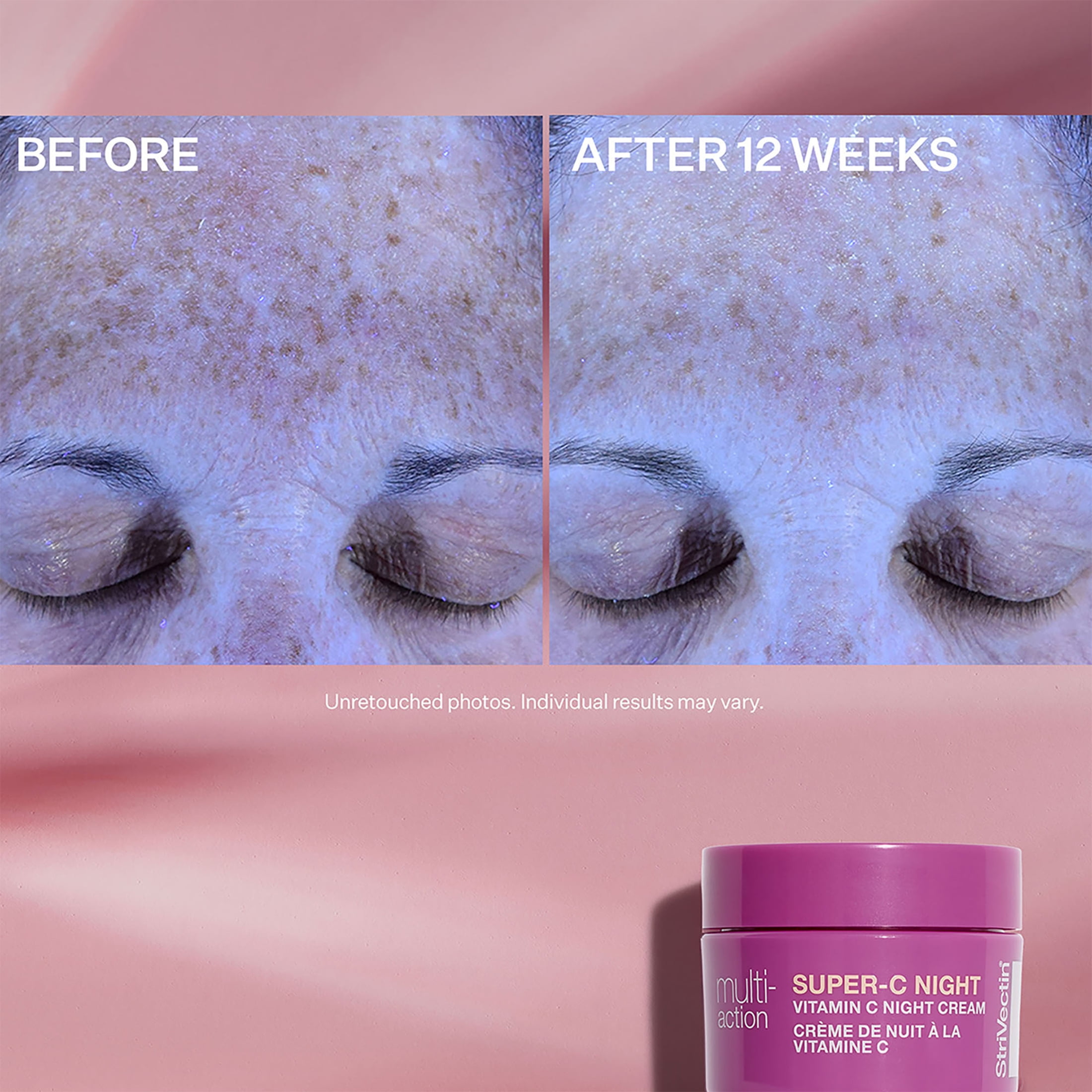StriVectin Multi-Action Trio: Brighten & Restore Kit, 3 Pieces