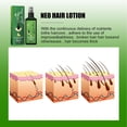 thumbnail image 5 of Sérum en aerosol para pérdida de cabello, adelgazamiento y crecimiento del cabello, 100 ml x 2, 5 of 5