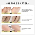 thumbnail image 5 of Cyperus Rotundus Oil - 60ml Natural Cyperus Rotundus Oil For Hair Removal Reducing Body Hair Growth, Moisturizing Soothing Cyperus Rotundus Oil Fo, 5 of 5