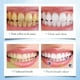 thumbnail image 5 of Pasta de dientes, Pasta de dientes blanqueadora, Pastillas de pasta de dientes masticables, Pastillas de pasta natural, Frasco ecológico, Sin flúor, Hidroxiapatita remineralizante, 30 Pastillas, una p, 5 of 5