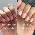 thumbnail image 4 of Esmalte fortalecedor de uñas Botanist The Remedy, 84% a base de plantas, 4 of 9