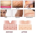 thumbnail image 4 of Crema para eliminar cicatrices quirúrgicas quemadas, Gel que se desvanece, reparación del acné, marcas de viruela, estrías, cicatriz de cesárea brillante, cuidado de la piel suave, 30g, 4 of 5