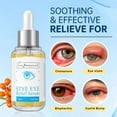 thumbnail image 6 of Stye Eye Treatment Serum Natural Remover with Styes Chalazion and Blepharitis, 1.01 Fl, 6 of 6