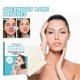 thumbnail image 1 of Parche para espinillas para el acné | Tratamiento hidrocoloide de manchas de acné: cuidado colorido, previene nuevas imperfecciones, reduce el tamaño, ingredientes naturales, seguro para pieles, 1 of 7