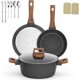 thumbnail image 1 of Juego de Sartenes Antiadherentes y Olla de Cocina, Batería de Cocina, 2 Sartenes y 1 Olla, Blanco - Perfecto para Cocinas Familiares (Negro), 1 of 4