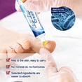 thumbnail image 1 of Crema Para Eliminar Hongos En Las Uñas, Crema Para Eliminar Hongos En Las Uñas, Onicomicosis, Crema Para Hongos En Las Uñas, Pomada Para El Cuidado De Las Uñas De Los Pies ANGGREK Nail Cream, 1 of 8