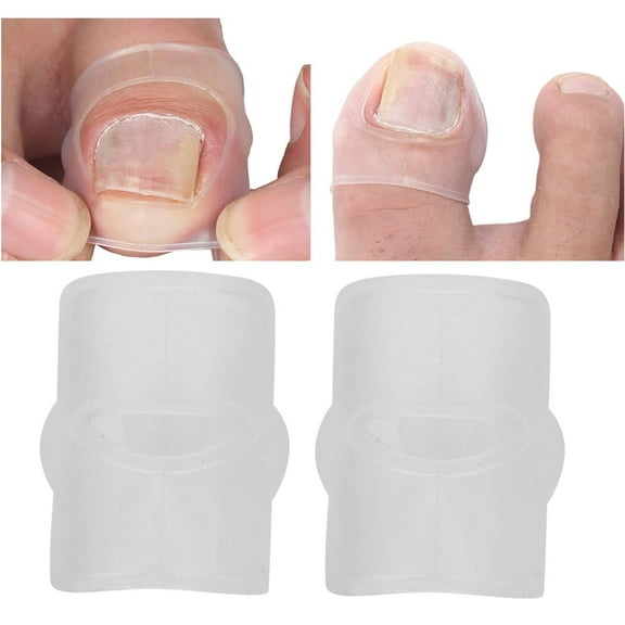 Brrnoo Ingrown Toenail Correction Tool,Paronychia Treatment Tool,2pcs Silicone Ingrown Toenail Correcting Tool Paronychia Treatment Corrector