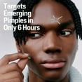 thumbnail image 3 of Fast Rescue Pimple Patches 24ct, 3 of 7