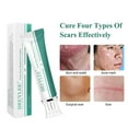 Advanced Scar Cream Scar Treatment for Surgical Scars, for Face,Keloids, CSection, Cosmetic