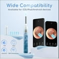 thumbnail image 2 of Earwax Removal - Electric Ear Irrigation Kit with 4 Pressure Modes, Ear Cleaner with Camera, 1080P Otoscope, Ear Cleaning Tool with 7-Piece Set, Earwax Removal Kit for, 2 of 8