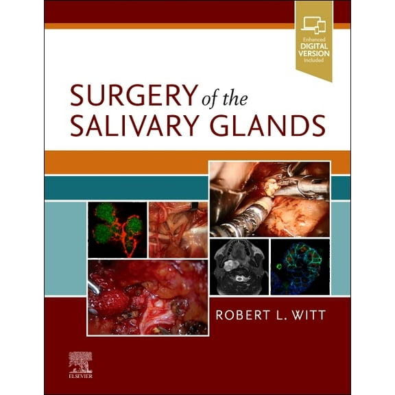Surgery of the Salivary Glands, (Hardcover)