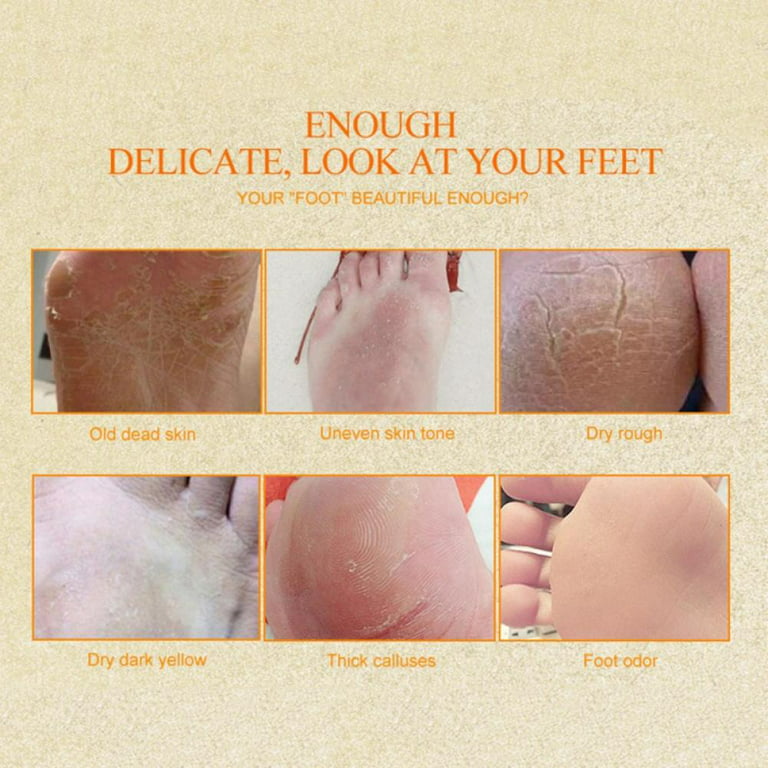 Foot Peel Mask,callus And Dead Skin Remover,nourish And Moisturize Dry  Rough Feet,soothe Cracked Feet And Heel - Temu