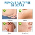 thumbnail image 6 of Silicone Scar Stick, Silicone Scar Sheets for Surgical Scars, Stretch Marks Removal, For Face and Body, 10g*2, 6 of 9