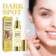thumbnail image 4 of Corrector de manchas oscuras, Yanshi rpemovedor de Pecas 30ml eliminación rápida y eficaz de manchas de acné para hombres y mujeres Yanshi Corrector de manchas oscuras, 4 of 6