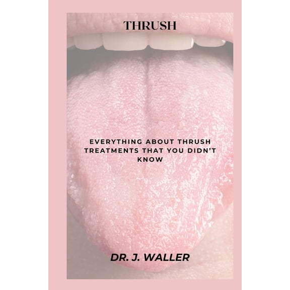 Thrush: Everything about Thrush Treatments That You Didn't Know, (Paperback)