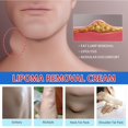 thumbnail image 5 of 3PCS Fat Knot Cream Relieves Fat Clumps Subcutaneous Lumps Body Care Cream, Relieves Fatty Lumps Tumors Subcutaneous, 5 of 5