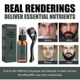 thumbnail image 4 of Kit de rodillo ZHAOCHENG para el crecimiento de la barba Aceite nutritivo, 4 of 5
