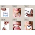 thumbnail image 3 of 4 bandejas bucales para blanqueamiento dental/lejía en gel, protector de goma termoformado, 11 Feliz Sencillez, 3 of 4