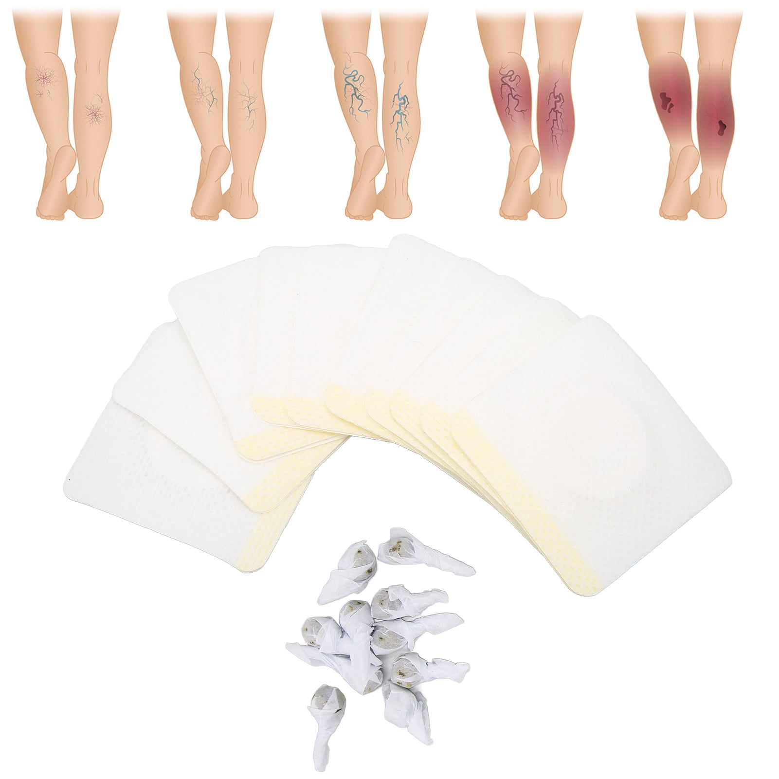 FAGINEY Leg Varicose Veins Patch,10pcs Varicose Veins Treatment Balls