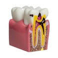 thumbnail image 4 of Modelo de caries dental 6 veces Estructura de automóvil de resina 315x217x335 Herramienta de aprendizaje educativo compacto para la demostración de au, 4 of 9