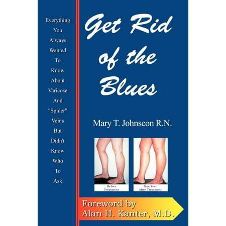 Get Rid of the Blues : Everything You Always Wanted to Know about Varicose and 