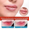 thumbnail image 3 of Vitamin E Infused Lip Balm for Dry, Cracked Lips, Natural Soothing Care for Chapped Lips Relief, 3 of 5