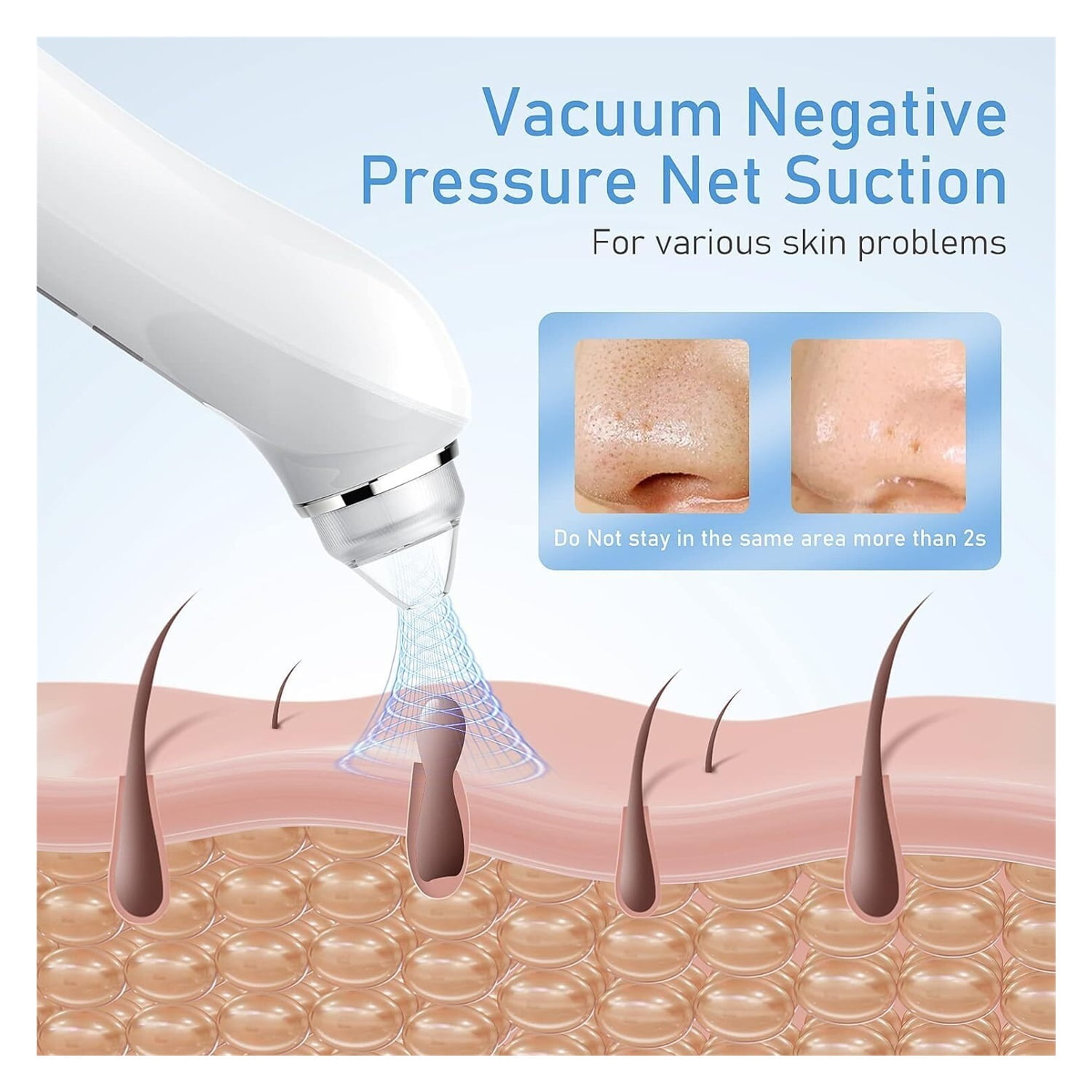 Blackhead Remover Vacuum, USB Interface Type Pore Vacuum, Black Head Extractions Tool with Camerafor, Men and Women Pore Cleaner, 3 Adjustment Modes & 6 Suction Heads(Light Pink)