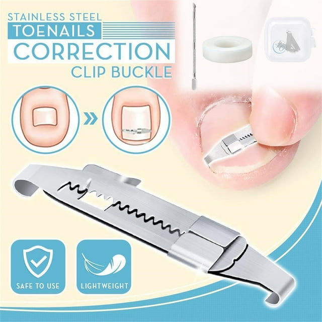 Fiudx Set Ortopédico para Corrección de Uñas, Fijador de Acero Inoxidable para Uñas Encarnadas, Elevadores Flexibles para Uñas de Todos Los Tamaños, Alivio Del Dolor Seguro y Eficaz, Uso Diario, Adul