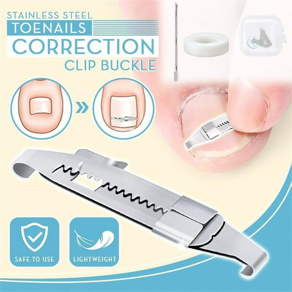 Herrnalise Ingrown Toenail Straightening Clip Stainless Steel Toenail Correction Clip Toenail Inset Buckle Toe Pedicure Tool
