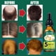 thumbnail image 5 of Productos para el cuidado del cabello Aceite de jengibre para el cuidado del cabello 30 ml, Líquido para el crecimiento del cabello Reduce la caída del cabello Cuidado del cabello un acondicionador, 5 of 5