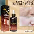 thumbnail image 2 of Aceite esencial para el cuidado de la piel para mujer, esencia hidratante que repara los poros grandes, productos para el cuidado Facial, belleza y salud, 2 of 5