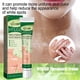 thumbnail image 1 of Crema para manchas dulces de 20g para hombres y mujeres crema para el tratamiento de manchas blancas suministros para el cuidado de la piel, 1 of 6