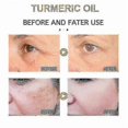 thumbnail image 5 of 30ml Turmeric Oil Pure Natural Pleasant Moisturizing Anti-aging, 5 of 5