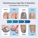 thumbnail image 2 of 2025 Nail Fungus Laser Treatment Device For Toenail Home Use 905nm Infrared Light 470nm Blue Light Therapy, 2 of 4
