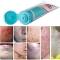 thumbnail image 4 of Crema para Eliminar Espinillas Hot6sl Ofertas y Liquidaciones Cuidado de La Piel 35 G, 4 of 7