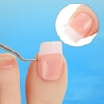 thumbnail image 4 of 100 Pcs Ingrown Toenail Corrector Strips with Toenail Lifter,Ingrown Toenail Correction Brace Toenail Correction Clip Toenail Straightening Recover Curved Toenail Corrector for Women Men Foot Care, 4 of 7