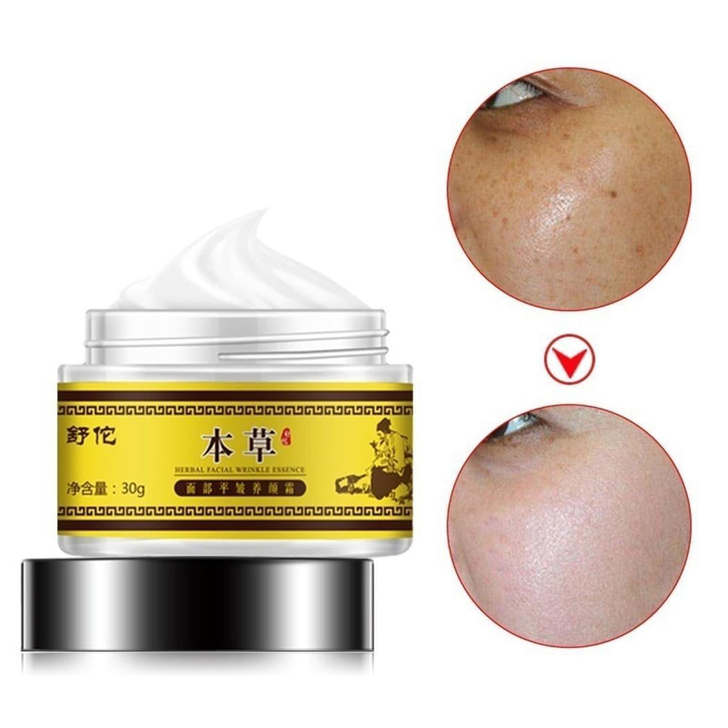 Skin Lightening Whitening Cream Spot Freckle Fade Removal Cream for