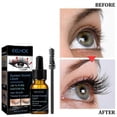 thumbnail image 5 of Suero para Crecimiento de Pestañas Eelhoe Enhancer Lash Boost 10ml shaofei, 5 of 5
