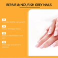 thumbnail image 5 of Bee Venom Nail Treatment Solution, Bee Venom Nail Fungus Treatment, Extra Strength Nail Repair Solution, Nail Fungus Care Spray, 5 of 5