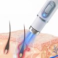 thumbnail image 3 of Profesional Mole Remover Skin Tag Pen para Tipo Piel (bolígrafo Extracción Verrugas), 3 of 9