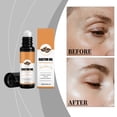 thumbnail image 4 of Roll On Castor Oil Organic,Organic Castor Oil Roll On,Castor Oil Rose Roller – Organic Cold-Pressed Castor Oil Roll-On(10ml/0.34fl.oz), 4 of 9