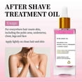 thumbnail image 3 of Natural Hair Beard Growth Derma Micro Dermaroller Hair Regrowth Anti Hair Loss Men Hair, 3 of 5