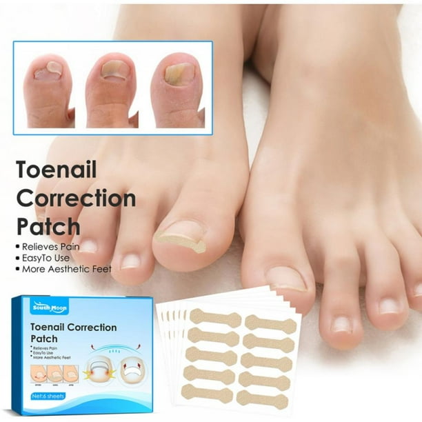 120pcs Ingrown Toenail Bandage, Toenail Correction Patch Paronychia