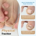 thumbnail image 4 of Unique Bargains Ingrown Toenail Correction Kit Toe Nail Corrector Tools with Leather Case for Easy Storage & Travel for Curved & Ingrown Nails with Nail Files Clipper Lifter, 4 of 7