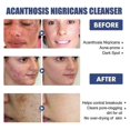 thumbnail image 2 of Black Acanthus Facial Cleanser Deep Cleansing, Softening, Skin Repair, Fading Facial Dullness, Whitening Facial Clea, 2 of 4