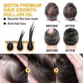 thumbnail image 2 of Biotin Dense Hair Series Deep Cleansing And Moisturizing Scalp Anti-Drop Solid Hair Dense Hair Care Shampoo Series, 2 of 5